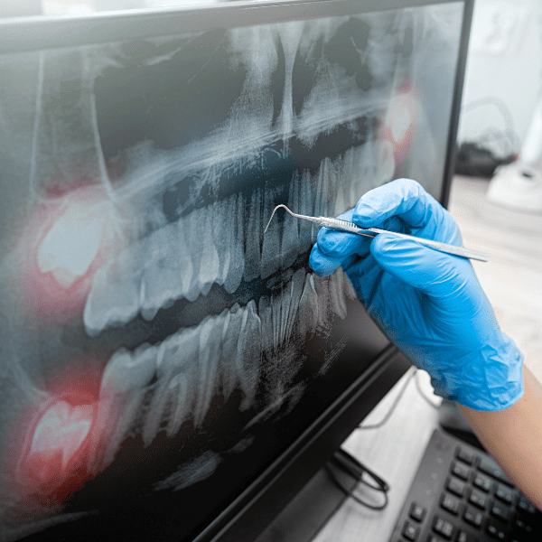 dental radiology