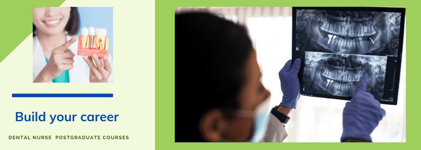 dental implant nurse training