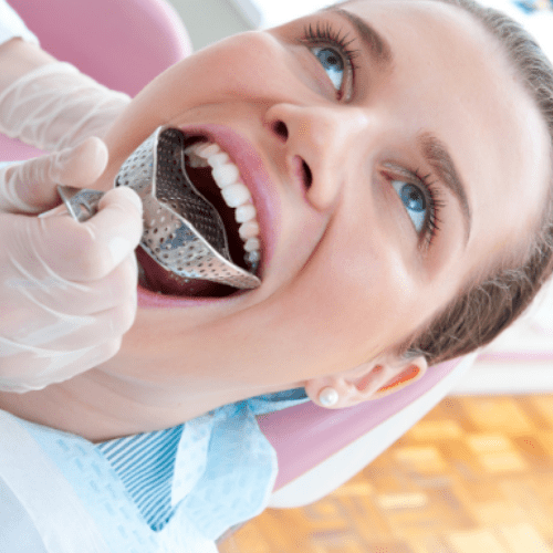 taking dental impression taking dental impression