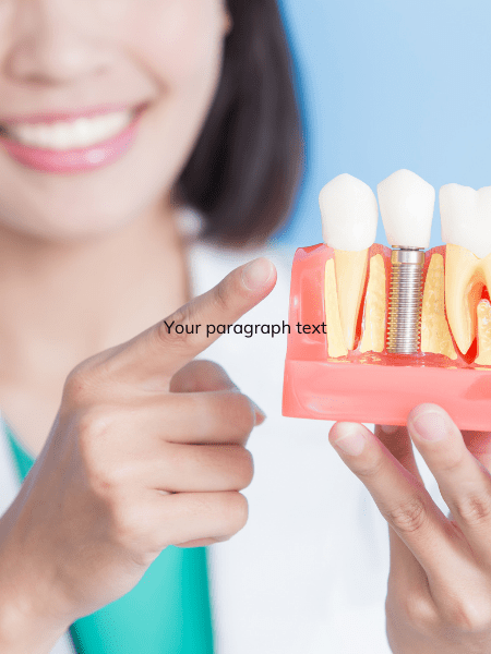 dental implant nurse training
