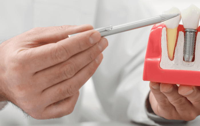 Explore dental nurse implant courses
